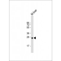 Western Blot at 1:2000 dilution + mouse liver lysate Lysates/proteins at 20 ug per lane.