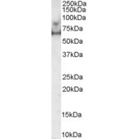 Western Blot (0.5μg/ml) staining of human prostate lysate (35μg protein in RIPA buffer). Primary incubated for 1 hour. Detected by western blot using chemiluminescence.