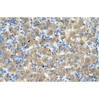Antibody used in IHC on Human Liver.