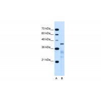 Antibody used in WB on Human Jurkat 0.25 ug/ml.