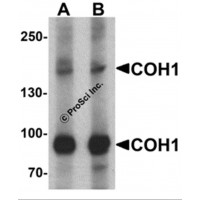 Western blot analysis of COH1 in SK-N-SH cell lysate with COH1 antibody at (A) 1 and (B) 2 μg/mL.