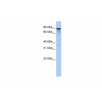 Antibody used in WB on Human HeLa at 1 ug/ml.