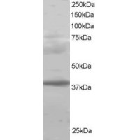 Western Blot staining (1μg/ml) of Human Lung lysate (RIPA buffer, 30μg total protein per lane). Primary incubated for 1 hour. Detected by western blot using chemiluminescence.
