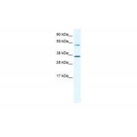 Antibody used in WB on Mouse SP2/0 at 1.25 ug/ml.