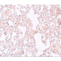 Immunohistochemistry of MFSD1 in rat lung tissue with MFSD1 antibody at 10 μg/mL.