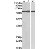 Western Blot (0.1μg/ml) staining of Mouse (A) and Rat (B) Heart, and Rat Kidney (C) lysates (35μg protein in RIPA buffer). Primary incubation was 1 hour. Detected by chemiluminescence.