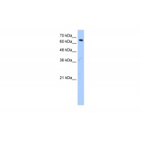 Antibody used in WB on Human HepG2 at 1.25 ug/ml.