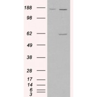 HEK293 overexpressing MAOA and probed with antibody (mock transfection in first lane).