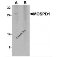 Western blot analysis of MOSPD1 in human brain tissue lysate with MOSPD1 antibody at 1 μg/mL in (A) the absence and (B) the presence of blocking peptide.