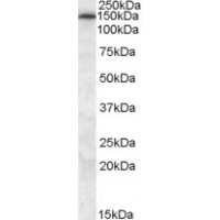 Western Blot (0.5μg/ml) staining of Human Frontal Cortex lysate (35μg protein in RIPA buffer). Primary incubation was 1 hour. Detected by chemiluminescence.