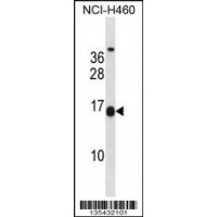 Western blot analysis in NCI-H460 cell line lysates (35ug/lane).