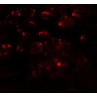 Immunofluorescence of MTERFD1 in 3T3 cells with MTERFD1 antibody at 20 μg/mL.