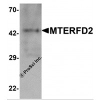 Western blot analysis of MTERFD2 in human small intestine tissue lysate with MTERFD2 antibody at 1 μg/mL.
