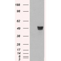 HEK293 overexpressing CORO1A and probed with antibody (mock transfection in first lane).