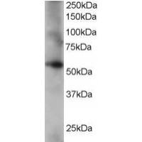 Western Blot staining (0.2μg/ml) of human lung lysate (RIPA buffer, 35μg total protein per lane). Primary incubated for 1 hour. Detected by western blot using chemiluminescence.