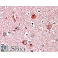 Immunohistochemistry (5μg/ml) staining of paraffin embedded Human Cortex. Steamed antigen retrieval with citrate buffer pH 6, AP-staining.