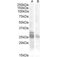 Western Blot (0.5μg/ml) staining of Muscle lysate (35μg protein in RIPA buffer) with (B) and without (A) blocking with the immunising peptide. Primary incubation was 1 hour. Detected by chemiluminescence.