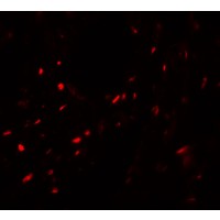 Immunofluorescence of MYOZAP in human lung tissue with MYOZAP antibody at 20 μg/mL.