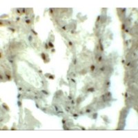 Immunohistochemistry of MYOZAP in human lung tissue with MYOZAP antibody at 5 μg/mL.