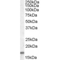 Western blot (1 μg/ml) staining of Human Skeletal Muscle lysate (35 μg protein in RIPA buffer). Primary incubation was 1 hour. Detected by chemiluminescence.