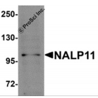 Western blot analysis of NALP11 in HeLa cell lysate with NALP11 antibody at 1 μg/mL.