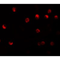 Immunofluorescence of NALP11 in HeLa cells with NALP11 antibody at 20 μg/mL.