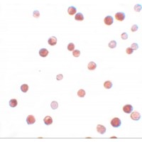 Immunocytochemistry of NALP11 in HeLa cells with NALP11 antibody at 2.5 μg/mL.