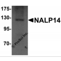 Western blot analysis of NALP14 in rat brain tissue lysate with NALP14 antibody at 1 μg/mL.