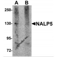 Western blot analysis of NALP5 in mouse brain tissue lysate with NALP5 antibody at 1 μg/mL in (A) the absence and (B) the presence of blocking peptide.