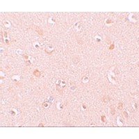 Immunohistochemistry of NALP5 in human brain tissue with NALP5 antibody at 10 μg/mL.