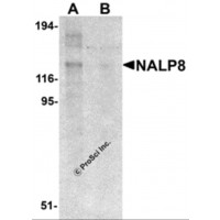 Western blot analysis of NALP8 in human colon tissue lysate with NALP8 antibody at 1 μg/mL in (A) the absence and (B) the presence of blocking peptide.