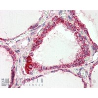 Immunohistochemistry (2.5μg/ml) staining of paraffin embedded Human Thyroid Gland. Steamed antigen retrieval with citrate buffer pH 6, AP-staining.