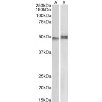 Western Blot 1μg/ml) staining of Mouse Thymus (A) and Pig Spleen (B) lysate (35μg protein in RIPA buffer). Primary incubation was 1 hour. Detected by chemiluminescence.