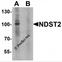 Western blot analysis of NDST2 in A-20 cell lysate with NDST2 antibody at 1 μg/ml in (A) the absence and (B) the presence of blocking peptide.
