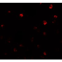 Immunofluorescence of NDST2 in Daudi cells with NDST2 antibody at 20 μg/ml.