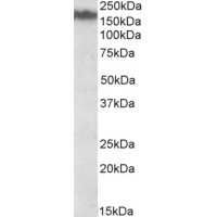Western Blot (0.03μg/ml) staining of Mouse Brain lysate (35μg protein in RIPA buffer). Primary incubation was 1 hour. Detected by chemiluminescence.