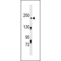 Western blot analysis in CEM cell line lysates (35ug/lane).