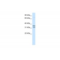 Antibody used in WB on Mouse SP2/0 at 0.125 ug/ml.