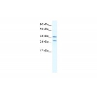 Antibody used in WB on Human Spleen at 0.25 ug/ml.