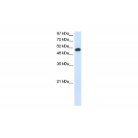 Antibody used in WB on Human Jurkat 0.2-1 ug/ml.