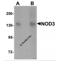 Western blot analysis of NOD3 in 3T3 cell lysate with NOD3 antibody at (A) 1 and (B) 2 μg/mL.