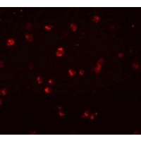 Immunofluorescence of NOD3 in Jurkat cells with NOD3 antibody at 20 μg/mL.