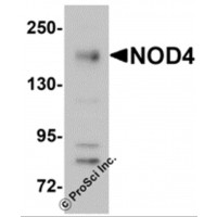 Western blot analysis of NOD4 in EL4 cell lysate with NOD4 antibody at 1 μg/mL.