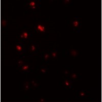 Immunofluorescence of NOD4 in HeLa cells with NOD4 antibody at 20 μg/mL.