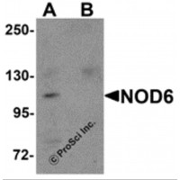 Western blot analysis of NOD6 in EL4 cell lysate with NOD6 antibody at 1 μg/mL in the (A) absence and (B) presence of blocking peptide.