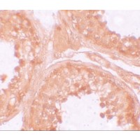 Immunohistochemistry of NOD6 in human testis tissue with NOD6 antibody at 10 μg/mL.