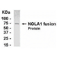 E coli-derived fusion protein as test antigen. Affinity-purified IgY dilution: 1:2000, Goat anti-IgY-HRP dilution: 1:1000. Colorimetric method for signal development.