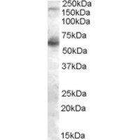 Western Blot (0.1μg/ml) staining of Human Skeletal Muscle lysate (35μg protein in RIPA buffer). Primary incubation was 1 hour. Detected by chemiluminescence.