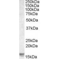 Western Blot (0.03μg/ml) staining of Human Cerebellum lysate (35μg protein in RIPA buffer). Primary incubation was 1 hour. Detected by chemiluminescence.