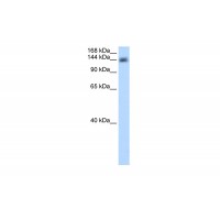 Antibody used in WB on Transfected 293T at 0.2-1 ug/ml.
